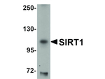 SIRT1 Antibody in Western Blot (WB)