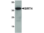 SIRT4 Polyclonal Antibody