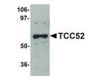 TCC52 Antibody in Western Blot (WB)