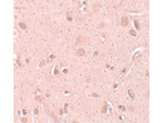 TINP1 Polyclonal Antibody