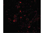 Transthyretin Polyclonal Antibody