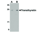 Transthyretin Antibody in Western Blot (WB)