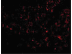 Human Serum Albumin Polyclonal Antibody