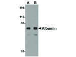 Human Serum Albumin Antibody in Western Blot (WB)