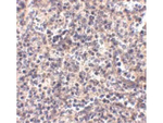 ATG5 Polyclonal Antibody