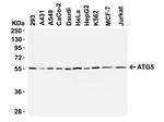 ATG5 Antibody in Western Blot (WB)