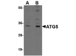 ATG5 Antibody in Western Blot (WB)