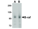 B-raf Polyclonal Antibody