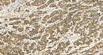 TP53BP1 Antibody in Immunohistochemistry (Paraffin) (IHC (P))