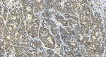TP53BP1 Antibody in Immunohistochemistry (Paraffin) (IHC (P))