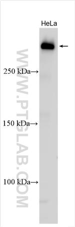 TP53BP1 Antibody in Western Blot (WB)