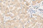 CYP4F2 Antibody in Immunohistochemistry (Paraffin) (IHC (P))