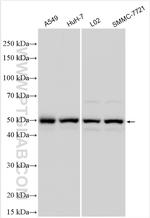 CYP4F2 Antibody in Western Blot (WB)