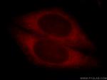 CYP4F11 Antibody in Immunocytochemistry (ICC/IF)