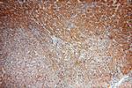 CYP4F11 Antibody in Immunohistochemistry (Paraffin) (IHC (P))