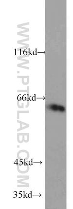 CYP4F11 Antibody in Western Blot (WB)