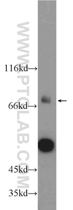 CYP4F11 Antibody in Western Blot (WB)