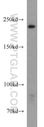 URB1 Antibody in Western Blot (WB)