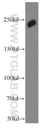 URB1 Antibody in Western Blot (WB)