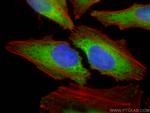 TBC1D4 Antibody in Immunocytochemistry (ICC/IF)