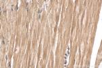 TBC1D4 Antibody in Immunohistochemistry (Paraffin) (IHC (P))