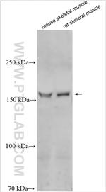 TBC1D4 Antibody in Western Blot (WB)