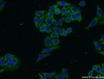 DLEC1 Antibody in Immunocytochemistry (ICC/IF)