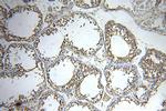 DLEC1 Antibody in Immunohistochemistry (Paraffin) (IHC (P))