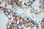 DLEC1 Antibody in Immunohistochemistry (Paraffin) (IHC (P))
