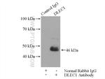 DLEC1 Antibody in Immunoprecipitation (IP)