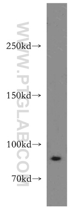 DLEC1 Antibody in Western Blot (WB)