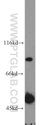 DLEC1 Antibody in Western Blot (WB)