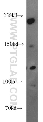 LAMC3 Antibody in Western Blot (WB)