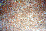 NCOA3 Antibody in Immunohistochemistry (Paraffin) (IHC (P))