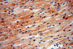 NCOA3 Antibody in Immunohistochemistry (Paraffin) (IHC (P))