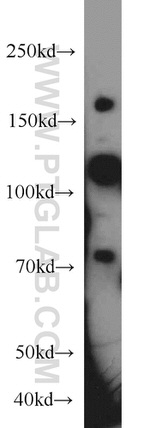 NCOA3 Antibody in Western Blot (WB)