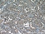 NCOA3 Antibody in Immunohistochemistry (Paraffin) (IHC (P))