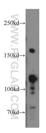 NCOA3 Antibody in Western Blot (WB)