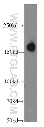 CIT Antibody in Western Blot (WB)