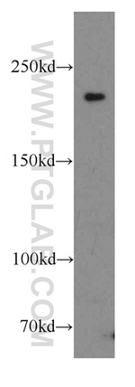 CIT Antibody in Western Blot (WB)