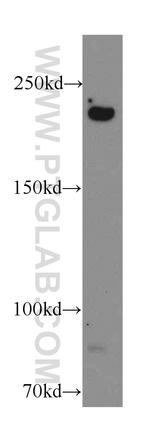 CIT Antibody in Western Blot (WB)