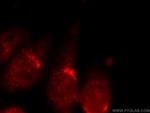 ANKRD26 Antibody in Immunocytochemistry (ICC/IF)