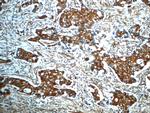 ANKRD26 Antibody in Immunohistochemistry (Paraffin) (IHC (P))