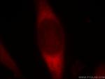 PDZD2 Antibody in Immunocytochemistry (ICC/IF)