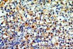 MPRIP Antibody in Immunohistochemistry (Paraffin) (IHC (P))