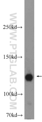 MPRIP Antibody in Western Blot (WB)