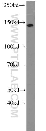 MPRIP Antibody in Western Blot (WB)