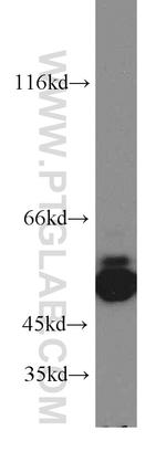 ARHGEF9 Antibody in Western Blot (WB)