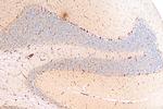 LPHN2 Antibody in Immunohistochemistry (Paraffin) (IHC (P))