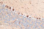 LPHN2 Antibody in Immunohistochemistry (Paraffin) (IHC (P))